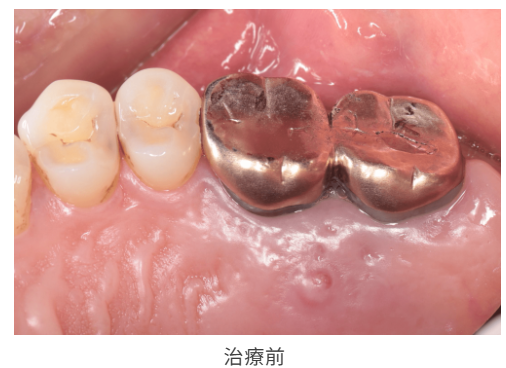 術前示意